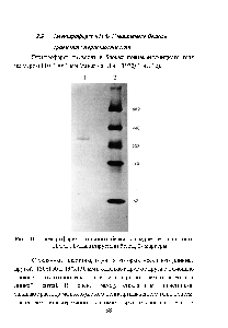 Рис. 16. Электрофорез нативного белка в <a href="/info/1897322">градиенте пористости ПААГ</a>. 1-анализируемый белок, 2- маркеры