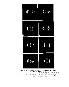 Рис. 214. Рентгенограммы ориентированных полиамидов, полученных из диаминов и дикарбоновых кислот.