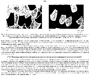 Рис. 17-38. Два <a href="/info/957907">последовательных среза</a> одного участка мышцы взрослой курицы, окрашенные <a href="/info/870284">флуоресцентными антителами</a>, специфическими для <a href="/info/1696521">двух</a> разных изоформ миозина. Л. Белые (быстро сокращающиеся) клетки окрашены антителами к быстрому миозину. Б. Красные (медленно сокращающиеся) клетки окрашены антителами к медленному миозину. (G. Gauthieret а ., J. ell Biol, 92, 471-484, 1982.)