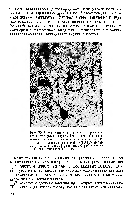 Рис. 29. Четковидная деформация верхушечного дендрита пирамидного нейрона <a href="/info/100588">коры головного мозга</a> крысы с исчезновением шипи ков на дендрите при интоксикации малыми дозами диметилформамида. Серебрение но Гольджи. Увеличение 900Х.