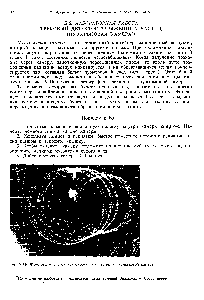 Рис. V.I6. <a href="/info/1517267">Фотография следов</a> <a href="/info/1121456">ионизированных частиц</a> в пузырьковой камере.
