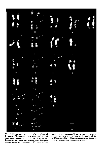 Рис. 7.3. Кариотип шимпанзе Pan troglodytes), Q-окрасжа Хромосома, соответствующая 2-й <a href="/info/105675">хромосоме человека</a>, очевидно, отсутствует Вместо нее имеются две дополнительные пары акроцентрических хромосом Стрелки указы-