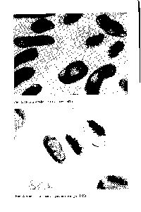 Рис. 2. Анафаза митоза с фрагментами (ув. 1500)