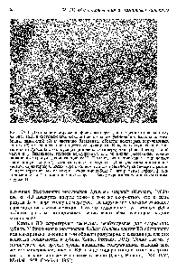 Рис. 16.4. Детальное изображение фрагмента среза, аналогичного показанному на рис. 16.2, в <a href="/info/510624">световом микроскопе</a> при большом увеличении. <a href="/info/509001">Базальная мембрана</a>, эндотелий ) и частично <a href="/info/1581754">базальные области</a> некоторых верхушечных клеток (2) отделились при <a href="/info/1897222">подготовке препарата</a>. Каждая верхушечная клетка тянется от дорсального синуса (3) до поверхности верхушки зубца. В <a href="/info/1585715">центральной части</a> и у базального полюса верхушечных клеток видны рассеянные темно-окрашенные гранулы, содержащие Fe . Плотное скопление гранул определяет гранулярную зону (- , отделенную от верхушки зубца участком апикальных клеток, характеризующихся чередованием темно- и светлоокрашеннызмзбмстей.