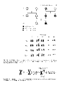 Рис. 2.60, Реципрокная транслокадия. Сбалансированная зигота имеет 46 хромосом в <a href="/info/1696521">двух</a> хромосомах видны комплементарные структурные аномалии.