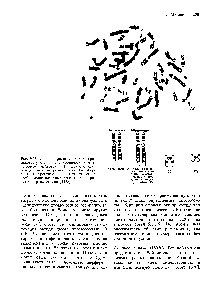 Рис. 5.35. Филадельфийская (РЬ ) хромосома у больного с хроническим миелоидным лейкозом. А. Транслокация между 22-й и 9-й хромосомами Аб аберрантная хромосома. Б. <a href="/info/376711">Схематическое изображение</a> исходных хромосом и продуктов транслокации [1478].