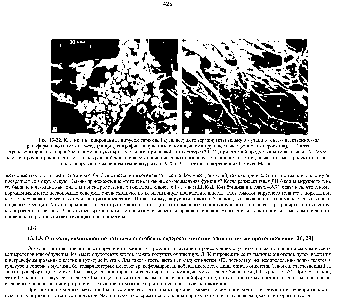 Рис. 13-32. Клетки, инфицированные <a href="/info/509148">вирусом саркомы Рауса</a>, несущего <a href="/info/1339433">термочувствительную мутацию</a> гена, ответственного за трансформацию (онкогена -sr ) (микрофотографии, полученные с помощью <a href="/info/129221">сканирующего электронного микроскопа</a>). А <a href="/info/200616">Клетки трансформированы</a> и приобрели аномальную округлую форму при низкой гемпературе (34 °С), при которой продукт онкогена активен. Б. Те же клетки, прочно прикрепленные к культуральной чашке и восстановившие свою нормальную уплощенную форму, после того как продукт онкогена